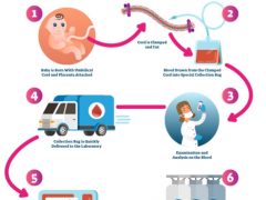 Private Cord Blood Banking