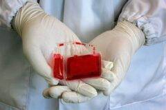 cord blood banking cost questions answered